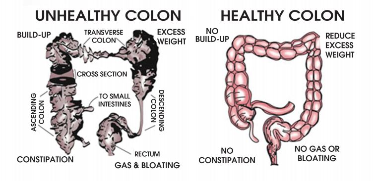 benefits of a colon cleanse