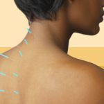 The Healing Power, 7 Incredible Benefits of Acupuncture benefits of accupuncture