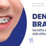Smile Confidently, Incredible Benefits of Braces benefits of braces