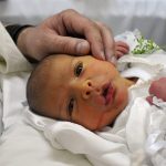 Hidden Benefits of Circumcision, A Closer Look at the Health Advantages benefits of circumcision