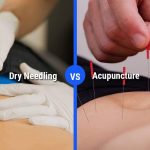 The Healing Power, Incredible Benefits of Dry Needling benefits of dry needling