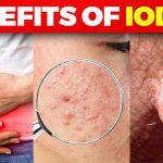 The Power of Iodine, 5 Incredible Benefits of Supplementation benefits of iodine supplementation