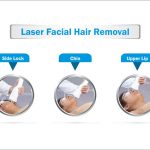 Secret to Smooth Skin, Incredible Benefits of Laser Hair Removal benefits of laser hair removal