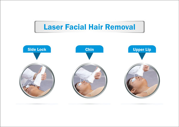 benefits of laser hair removal