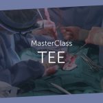 Hidden Advantages, Benefits of Tee Test benefits of tee test
