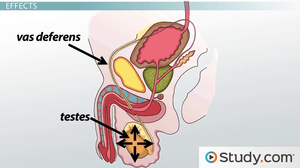 benefits of vasectomy