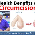 The Hidden Benefits of Circumcision, A Life-Changing Choice benefits of.circumcision