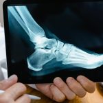 Step Towards Relief Finding the Best Podiatrist Near Me best podiatrist near me