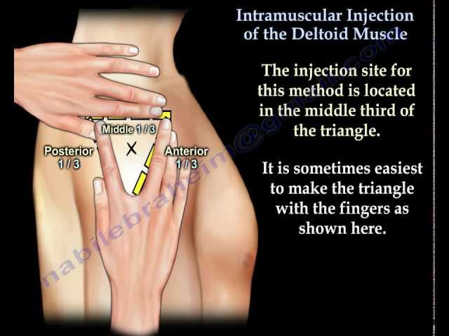 intramuscular injection