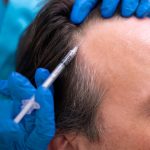 The Secret to Youthful Skin with PRP Treatment prp treatment