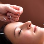The Healing Power, Top 10 Benefits of Acupuncture top 10 benefits of acupuncture