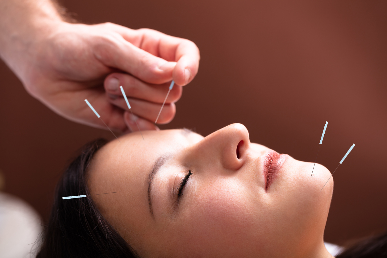 top 10 benefits of acupuncture