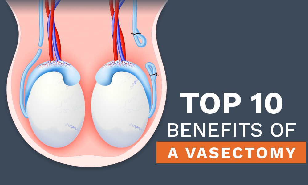 benefits of a vasectomy