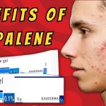 The Beauty Secrets, Incredible Benefits of Adapalene benefits of adapalene