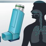 Breath of Fresh Air, Incredible Benefits of Albuterol benefits of albuterol