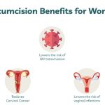 The Benefits of Being Circumcised, A Life-Changing Decision benefits of being circumcised