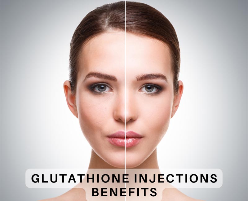 benefits of glutathione injections