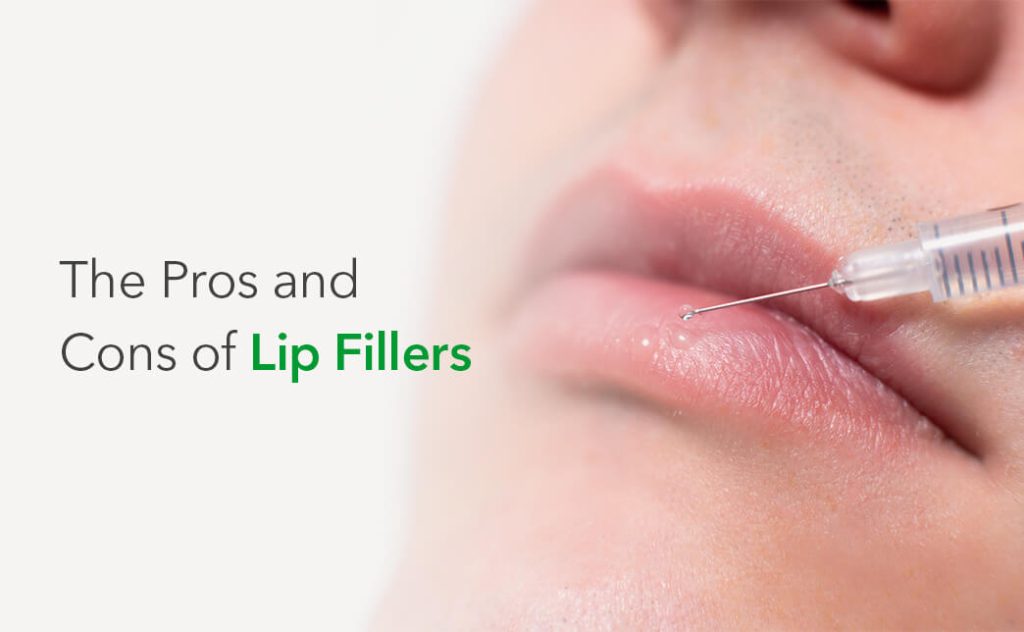 benefits of lip fillers