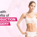 Slim Down and Feel Confident, Astonishing Benefits of Liposuction benefits of liposuction