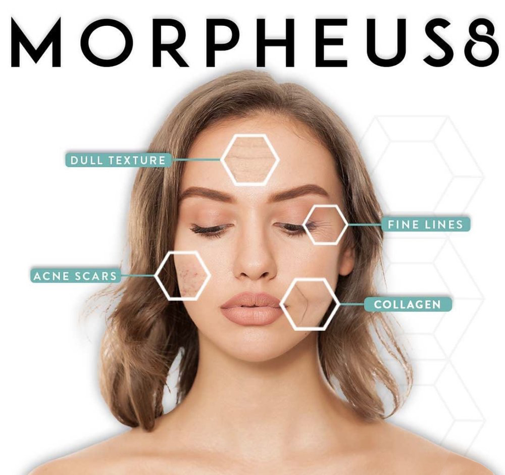 benefits of morpheus8