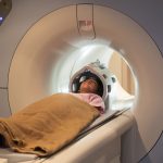 The Incredible Benefits of MRI for Accurate Diagnoses and Improved Treatment benefits of mri