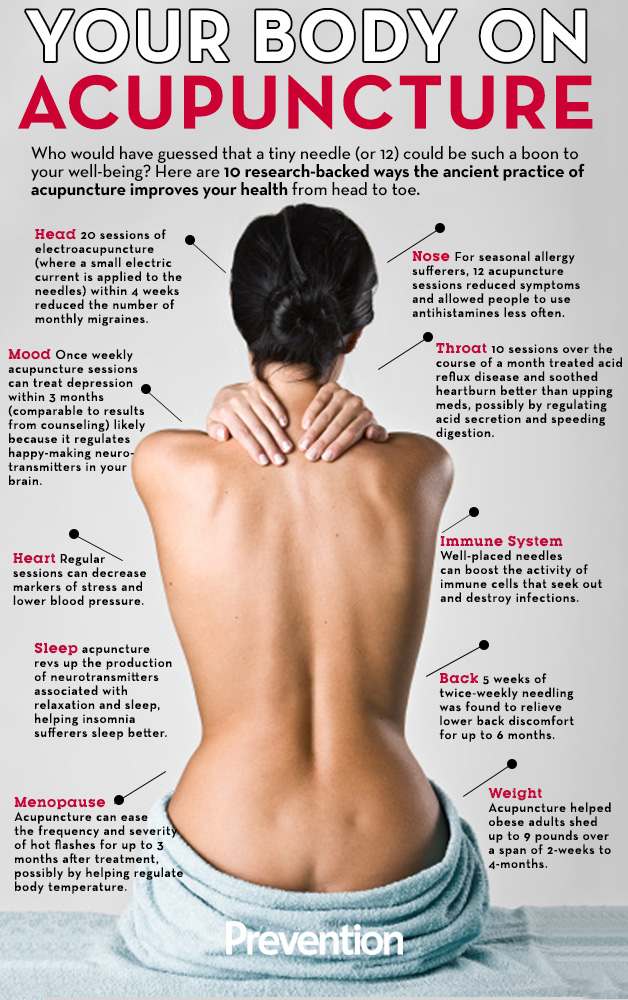 benefits of regular acupuncture