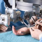 Revolutionizing Healthcare, the Incredible Benefits of Robotic Surgery benefits of robotic surgery