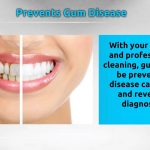 Smile Brighter, the Remarkable Benefits of Teeth Cleaning benefits of teeth cleaning