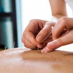 The Healing Powers, Incredible Health Benefits of Acupuncture health benefits of acupuncture