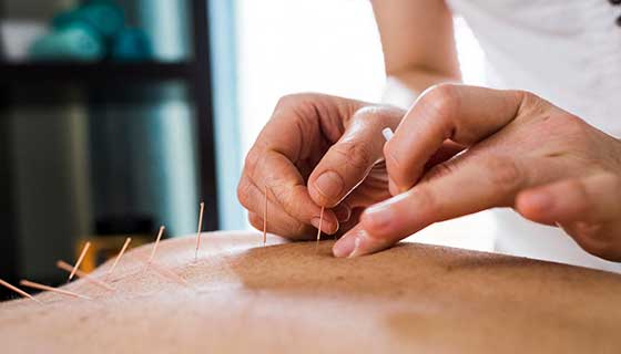 health benefits of acupuncture