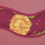 Incredible Health Benefits of Metamucil for a Happier and Healthier You health benefits of metamucil
