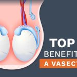 Wellness, The Surprising Health Benefits of Vasectomy health benefits of vasectomy