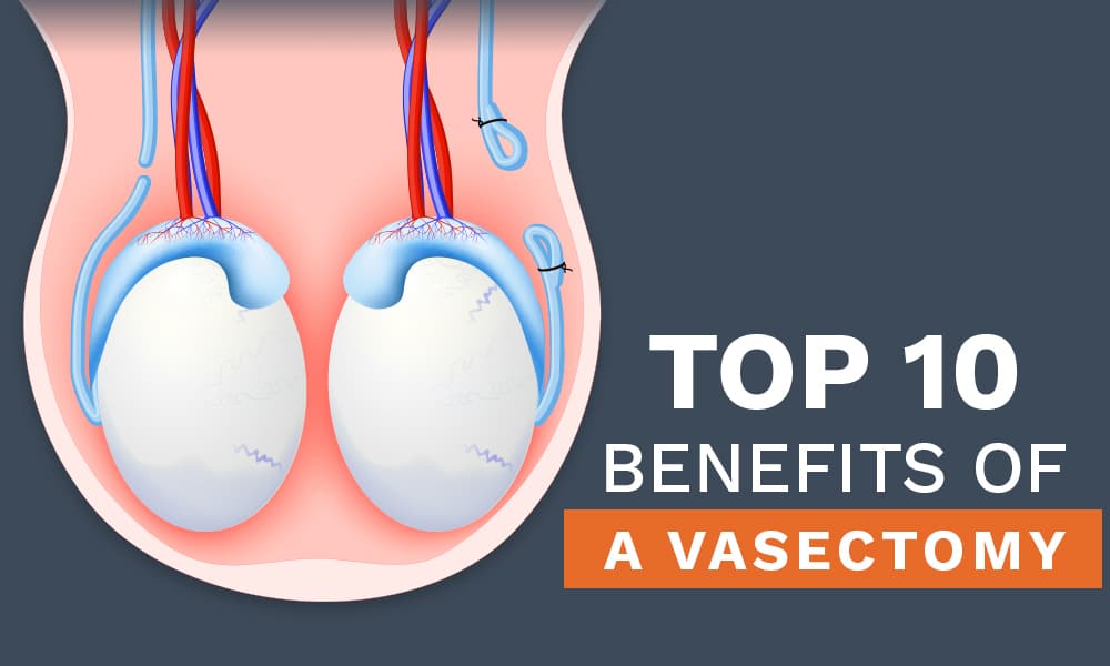 health benefits of vasectomy