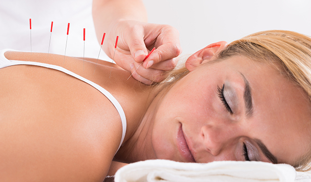 long-term benefits of acupuncture