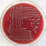 Pathogenic Drug Resistant Bacteria Found in Ukraine War Victims Klebsiella pneumoniae