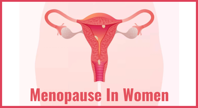 female-menopause