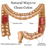 Clean Your Colon in 2 Weeks: These Recipes Will Help Remove 8 KG of Waste From Your Body Clean Your Colon in 2 Weeks: These Recipes Will Help Remove 8 KG of Waste From Your Body
