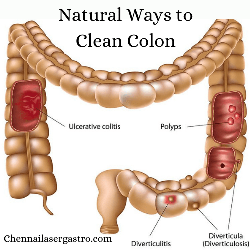 Clean Your Colon in 2 Weeks: These Recipes Will Help Remove 8 KG of Waste From Your Body