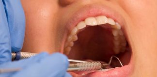 Flossing and Heart Health: How a Simple Habit Can Lower Stroke and AFib Risk