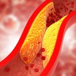 Cholesterol: The Good, the Bad, and How to Keep It in Check Cholesterol