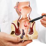 Don’t Let Colorectal Cancer Catch You Off Guard Don’t Let Colorectal Cancer