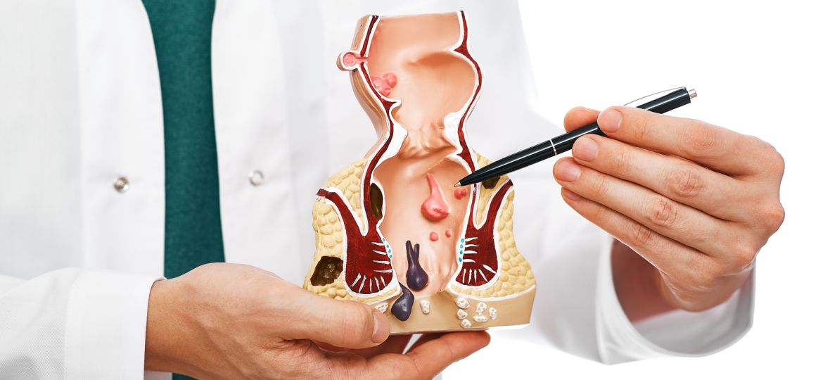 Don’t Let Colorectal Cancer