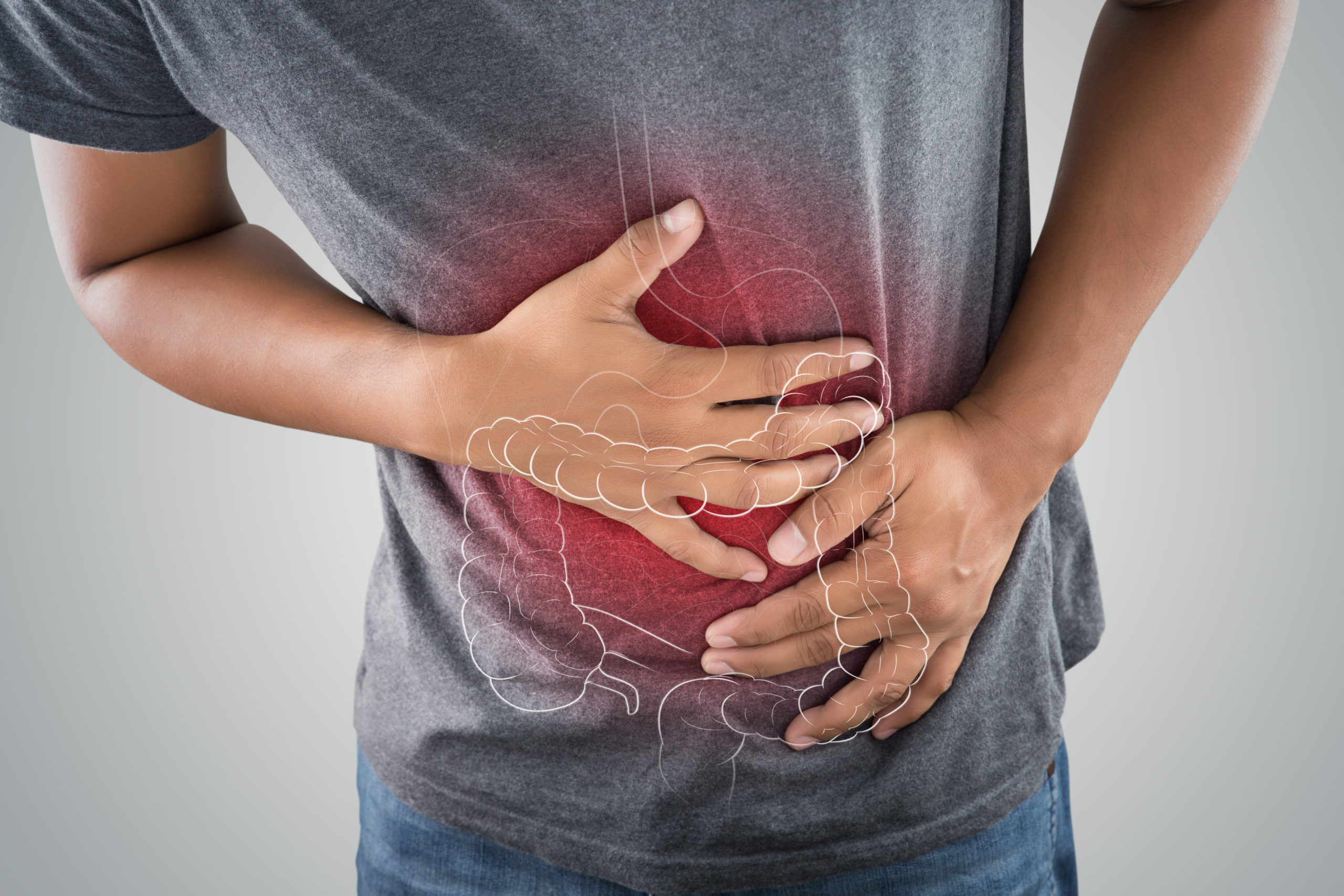 Prevent Colon Cancer