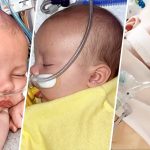 RSV in Babies and Adults RSV in Babies