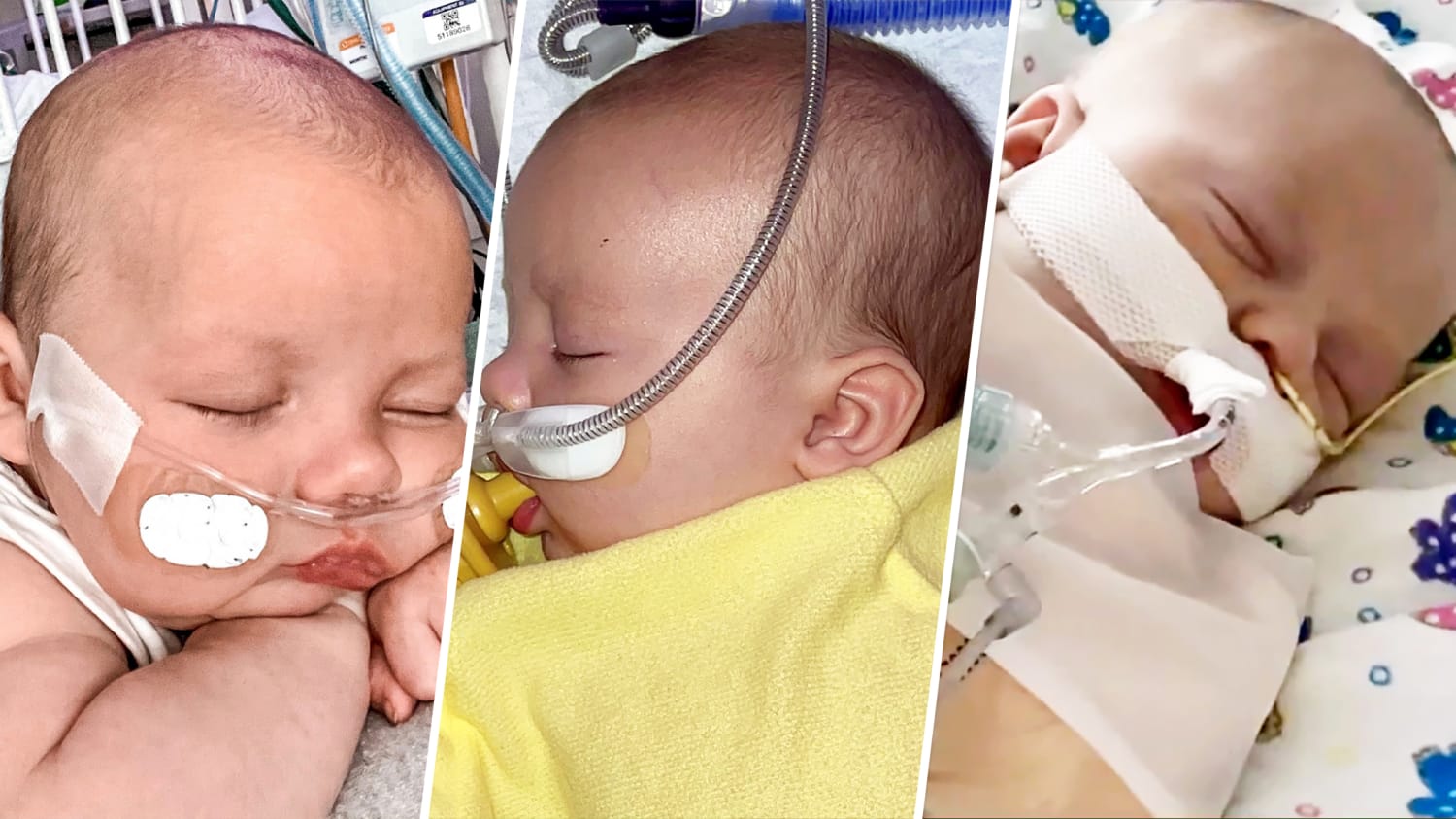 RSV in Babies