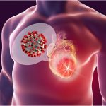 COVID-19 and Heart Health: What Cardiac Patients Need to Know COVID-19 and Heart Health