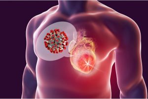 COVID-19 and Heart Health