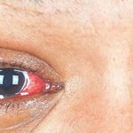 What’s Hurting Your Eyes and Ears What's Hurting Your Eyes and Ears