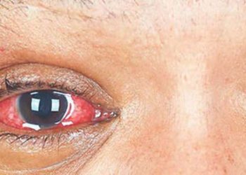 What's Hurting Your Eyes and Ears