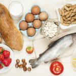 Food Allergies Food Allergies